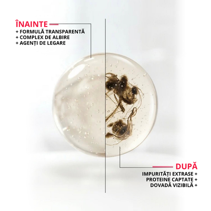 ClearWhite Smile™: Noua Soluție Bucală de Albire Împotriva Petelor